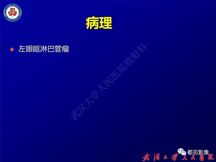 【病例】眼眶淋巴管瘤1例MR影像诊断