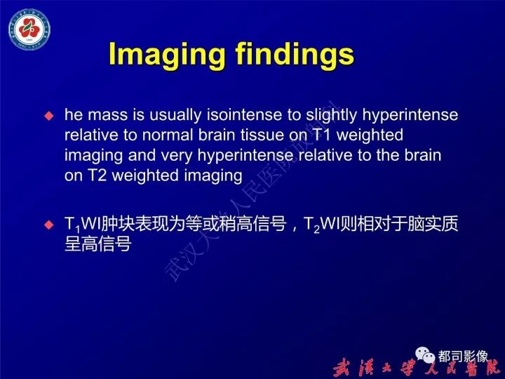 【病例】眼眶淋巴管瘤1例MR影像诊断