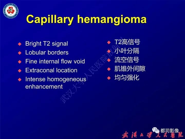 【病例】眼眶淋巴管瘤1例MR影像诊断