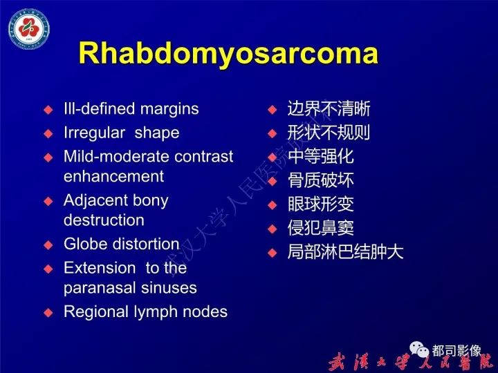 【病例】眼眶淋巴管瘤1例MR影像诊断
