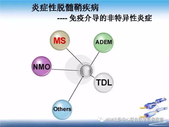 【PPT】中枢神经系统脱髓鞘疾病