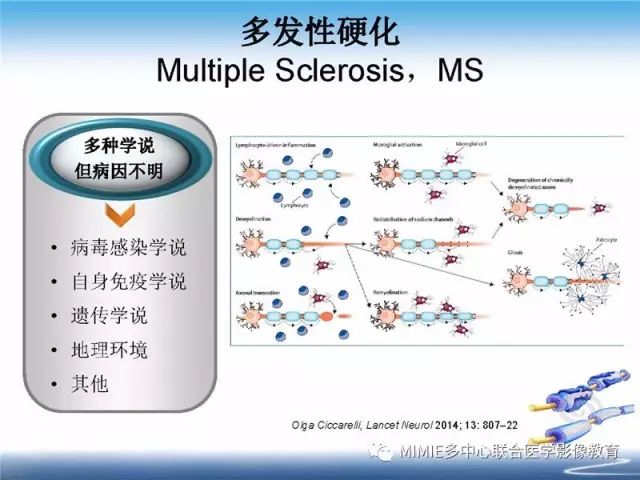 【PPT】中枢神经系统脱髓鞘疾病