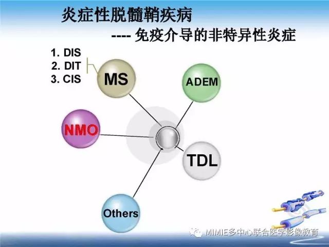 【PPT】中枢神经系统脱髓鞘疾病
