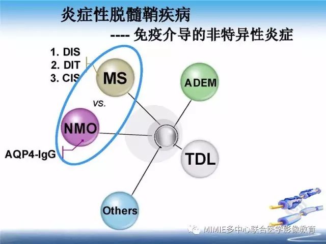 【PPT】中枢神经系统脱髓鞘疾病