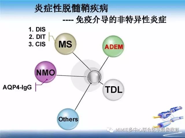 【PPT】中枢神经系统脱髓鞘疾病