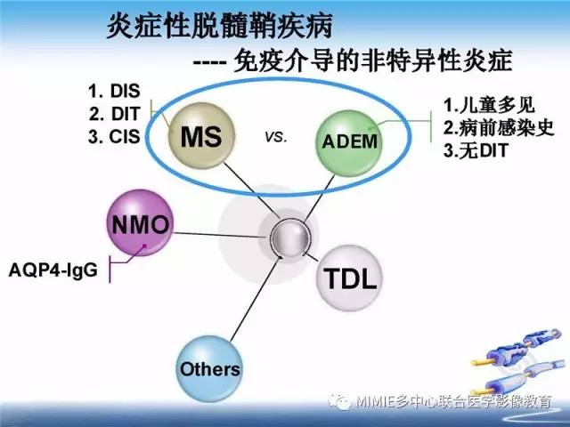 【PPT】中枢神经系统脱髓鞘疾病