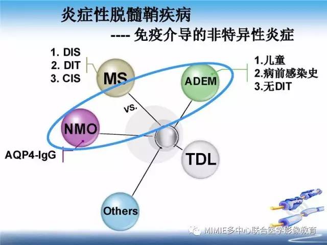 【PPT】中枢神经系统脱髓鞘疾病
