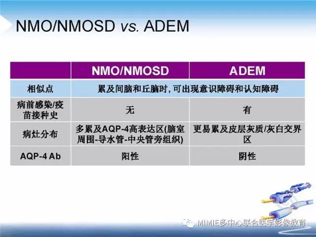【PPT】中枢神经系统脱髓鞘疾病