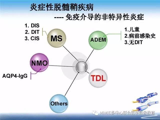【PPT】中枢神经系统脱髓鞘疾病