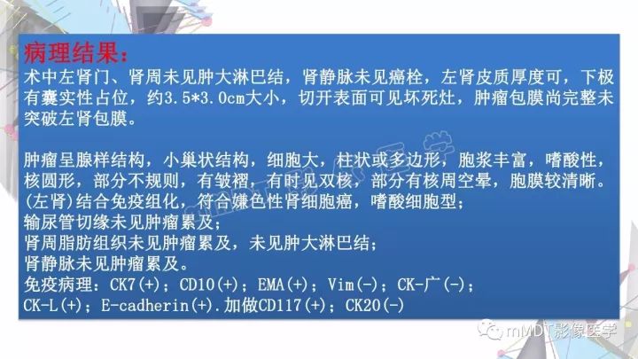 【PPT】肾嫌色细胞癌影像诊断