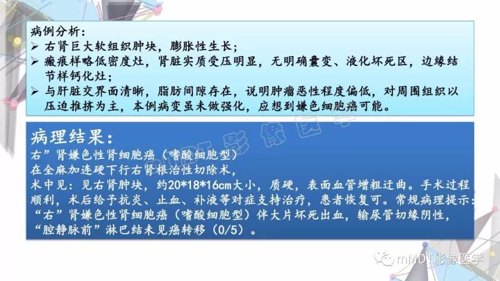 【PPT】肾嫌色细胞癌影像诊断