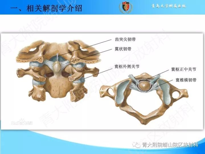 【PPT】颅颈交界区相关影像学测量