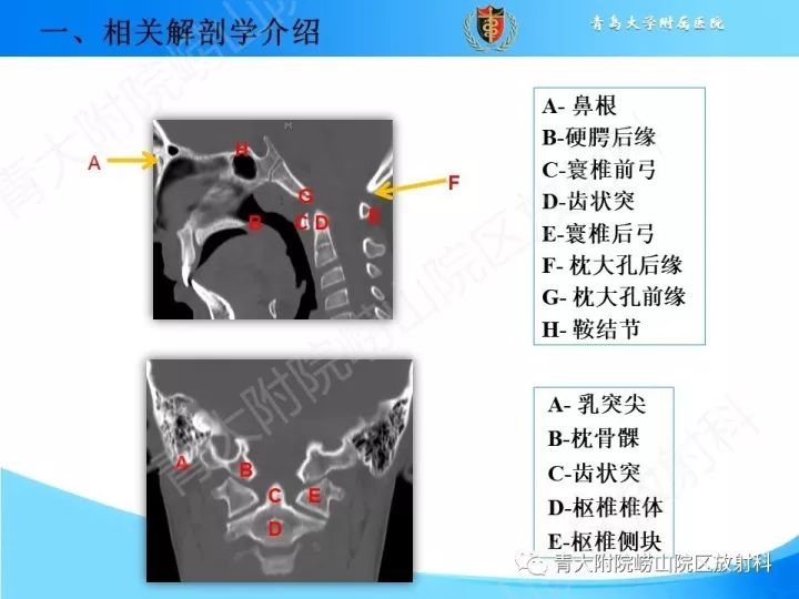 【PPT】颅颈交界区相关影像学测量