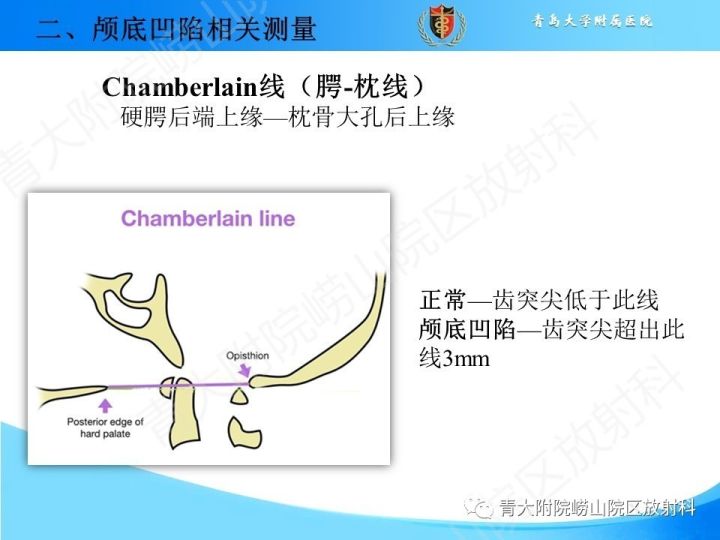 【PPT】颅颈交界区相关影像学测量