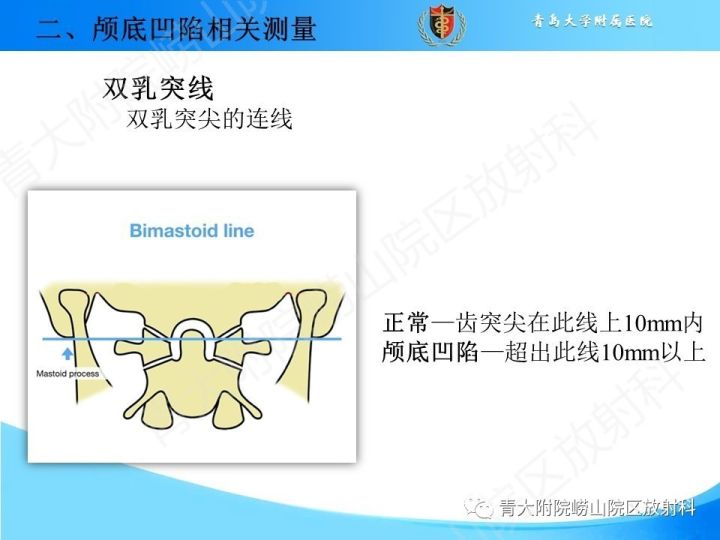 【PPT】颅颈交界区相关影像学测量