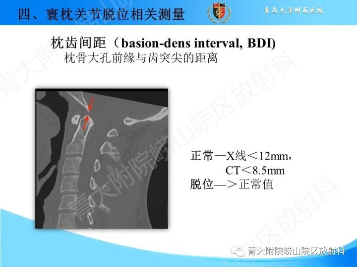 【PPT】颅颈交界区相关影像学测量