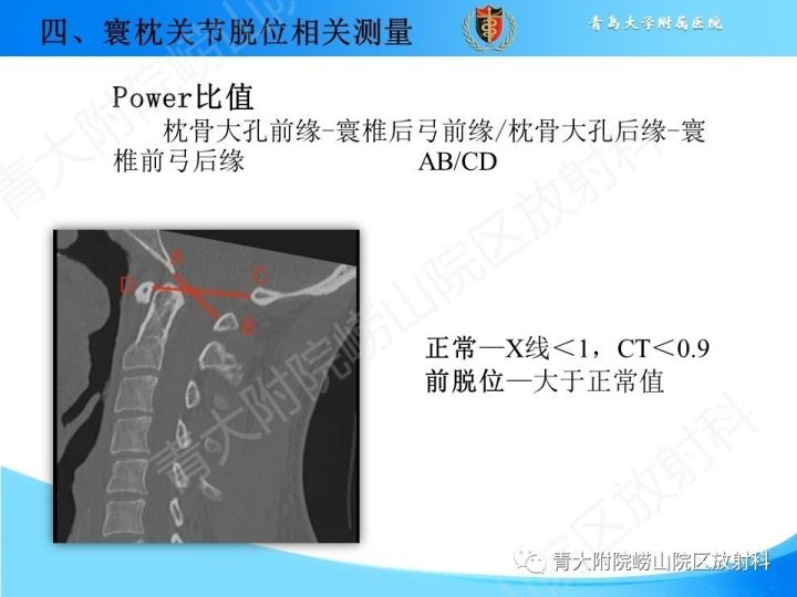 【PPT】颅颈交界区相关影像学测量
