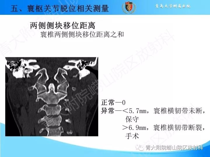 【PPT】颅颈交界区相关影像学测量