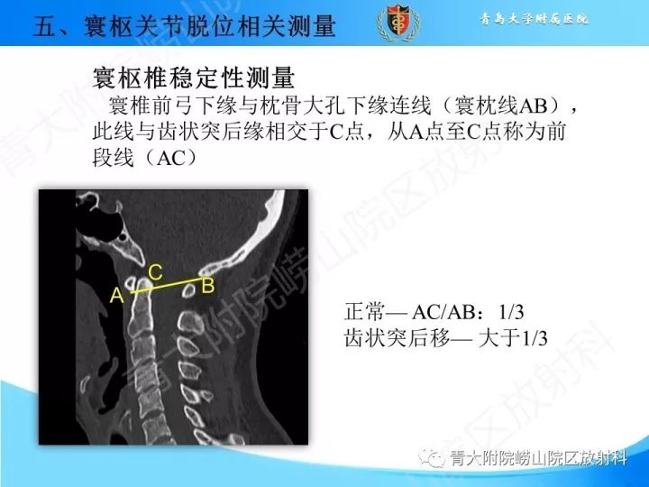【PPT】颅颈交界区相关影像学测量