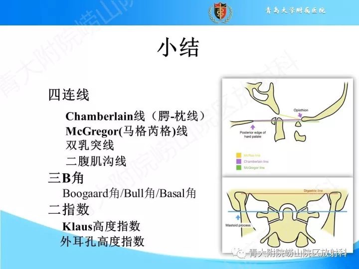 【PPT】颅颈交界区相关影像学测量