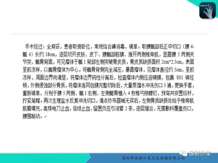 【病例】骶骨神经纤维瘤1例CT及MR