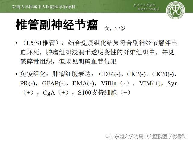 【病例】嗜铬细胞瘤2例CT影像表现