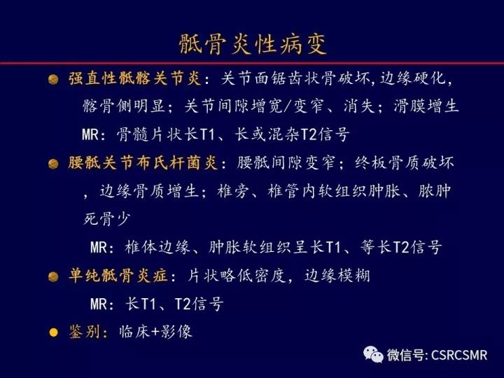 【PPT】骶骨病变的影像诊断与鉴别诊断