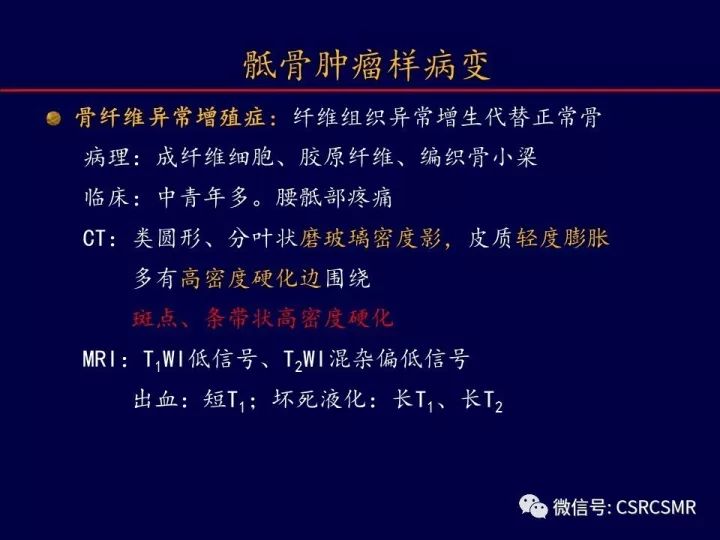 【PPT】骶骨病变的影像诊断与鉴别诊断
