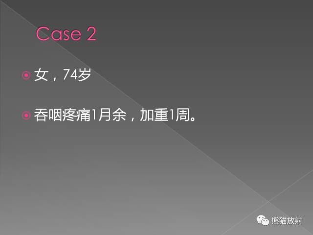 【PPT】扁桃体淋巴瘤——影像表现