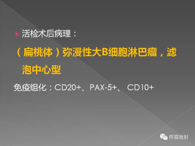 【PPT】扁桃体淋巴瘤——影像表现