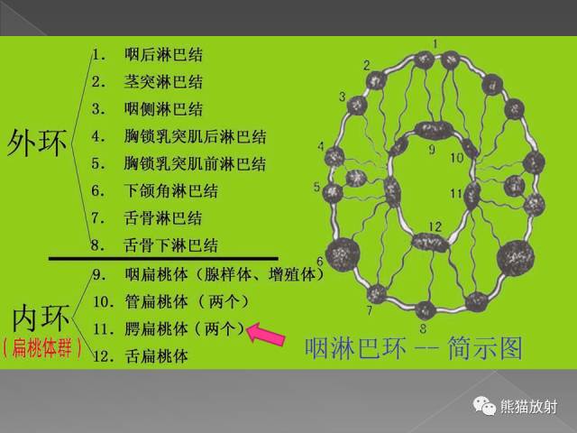 【PPT】扁桃体淋巴瘤——影像表现