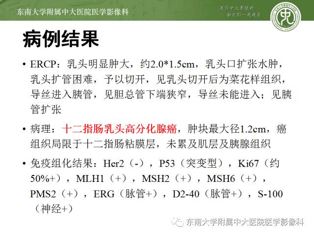 【病例】十二指肠乳头腺癌1例CT影像表现