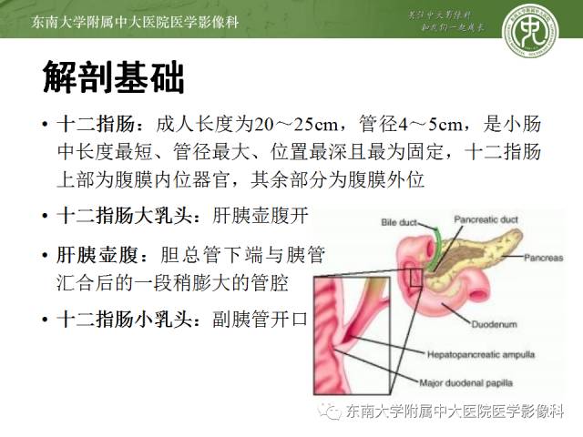 【病例】十二指肠乳头腺癌1例CT影像表现