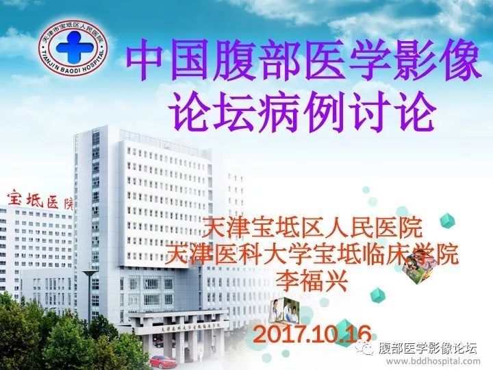 【病例】小肠系膜侵袭性纤维瘤病1例CT影像表现