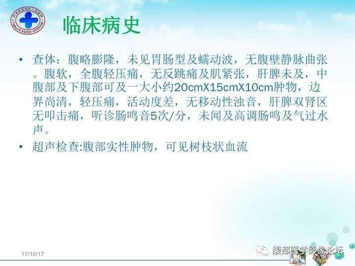 【病例】小肠系膜侵袭性纤维瘤病1例CT影像表现