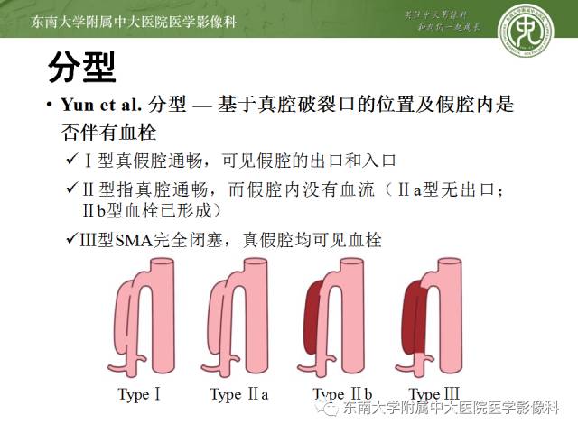 【病例】自发性孤立性肠系膜上动脉夹层1例CT