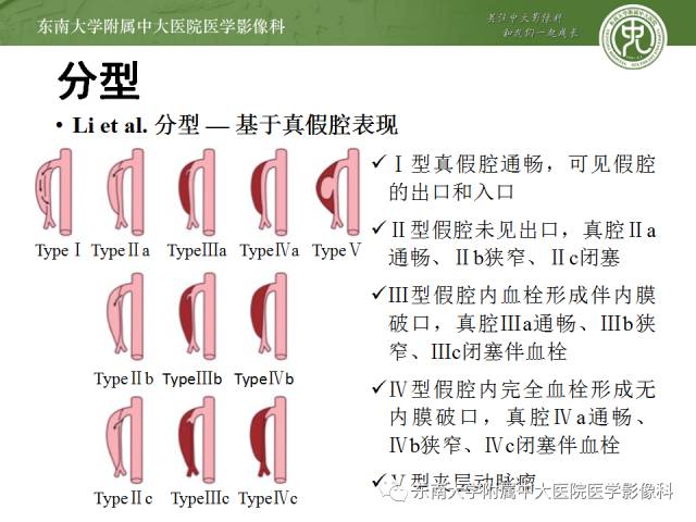 【病例】自发性孤立性肠系膜上动脉夹层1例CT