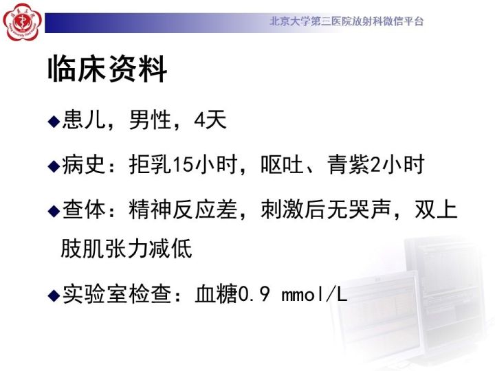 【病例】低血糖脑病1例MR影像表现