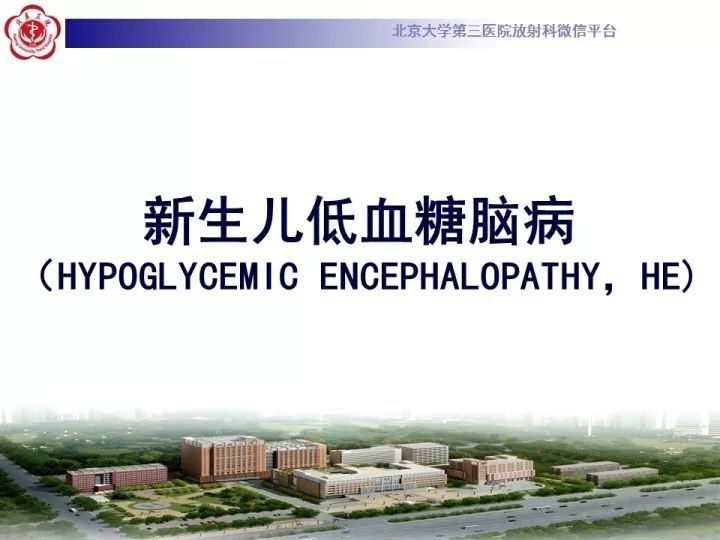 【病例】低血糖脑病1例MR影像表现