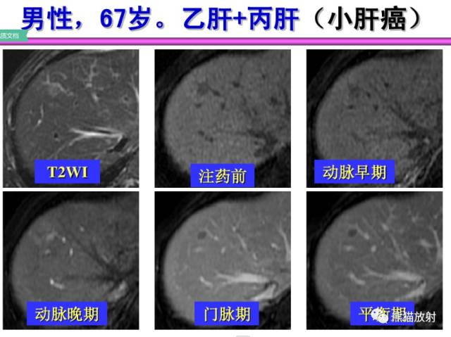 自动草稿