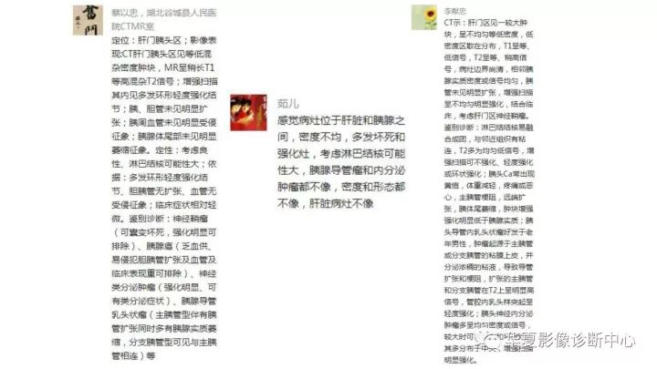 【病例】肝门区淋巴结结核1例CT及MR