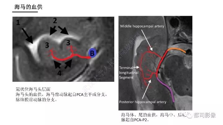 【PPT】海马正常解剖与疾病影像诊断