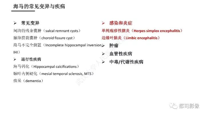 【PPT】海马正常解剖与疾病影像诊断