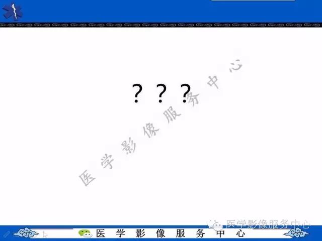 【病例】脑室内脑膜瘤1例MR