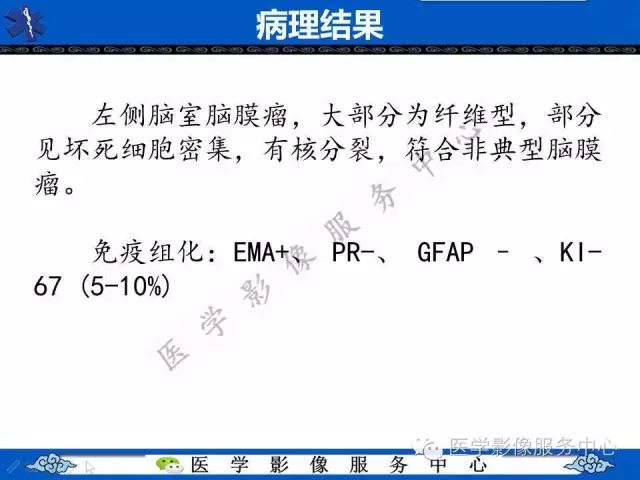 【病例】脑室内脑膜瘤1例MR