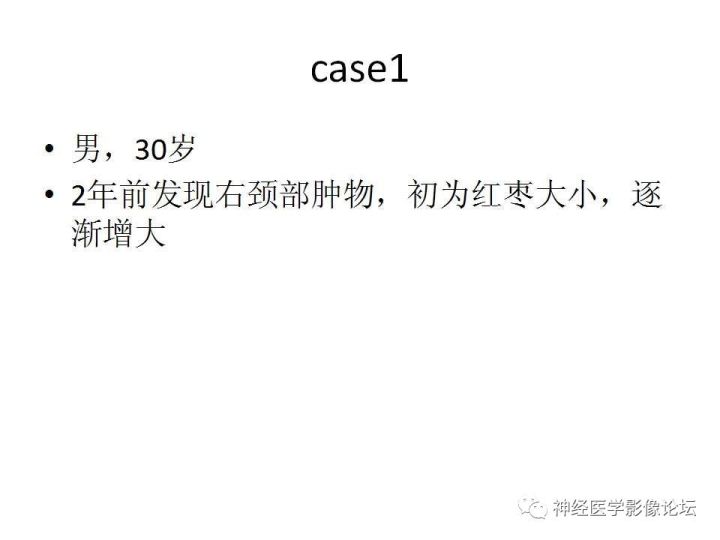 【病例】颈部淋巴管瘤VS神经鞘瘤