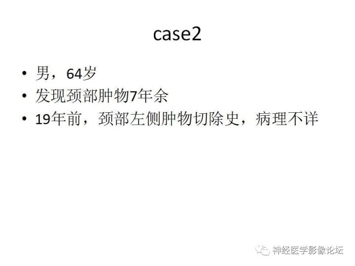 【病例】颈部淋巴管瘤VS神经鞘瘤