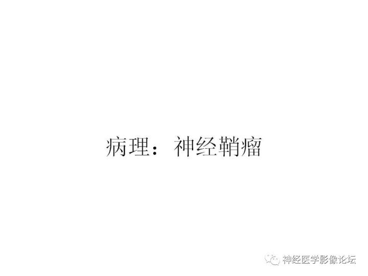 【病例】颈部淋巴管瘤VS神经鞘瘤