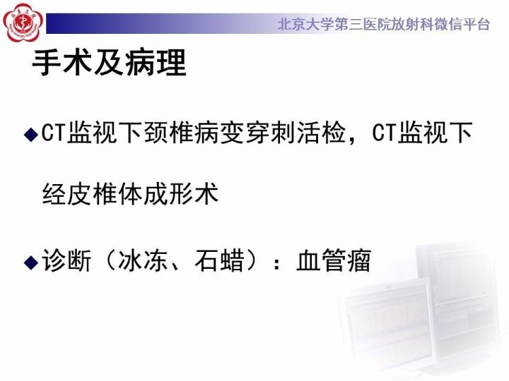 【病例】颈椎血管瘤1例CT及MR