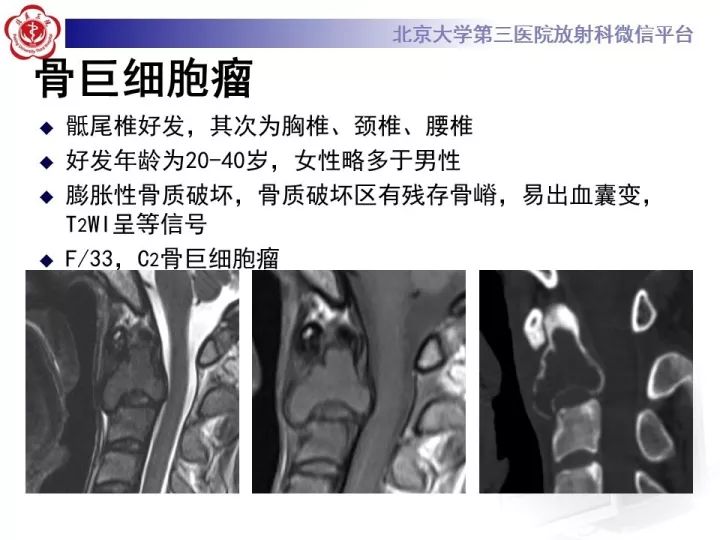 【病例】颈椎血管瘤1例CT及MR